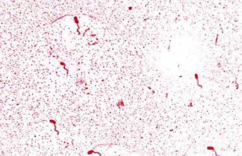 黑臭水體中微生物的來源有哪些？